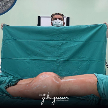 Slider image (3) Dr. Zeki Yasar Clinic